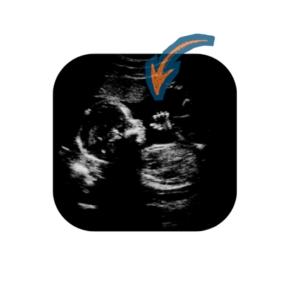 Une préférence qui apparaît très tôt